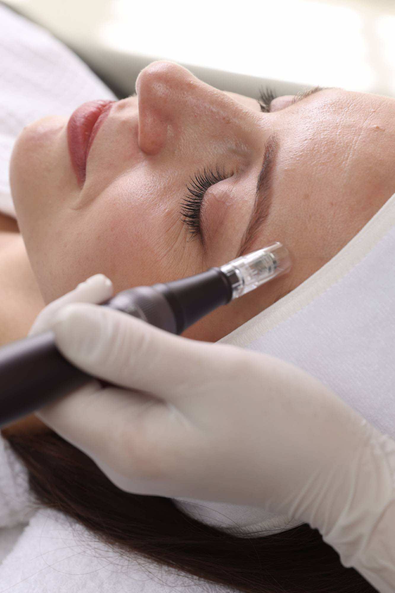 laserskin-by-hajni-baudapest-allo-5