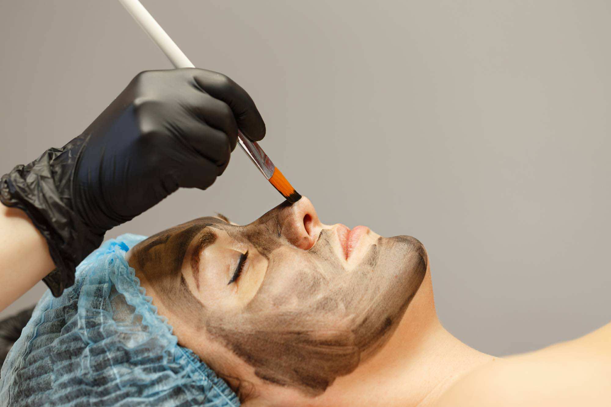 Szénmaszk felvitele Carbon Peeling kezeléshez